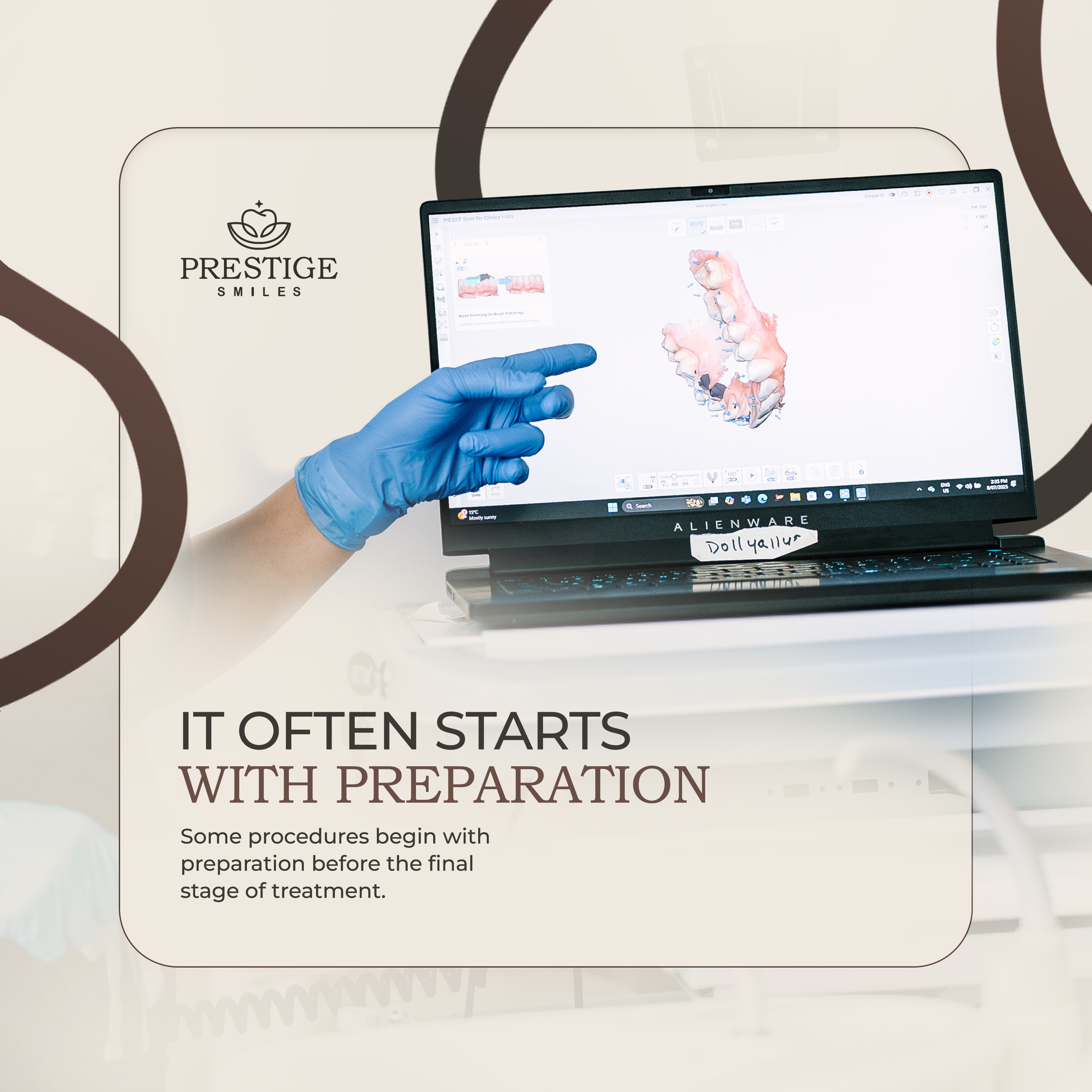 It Often Starts With Preparation
